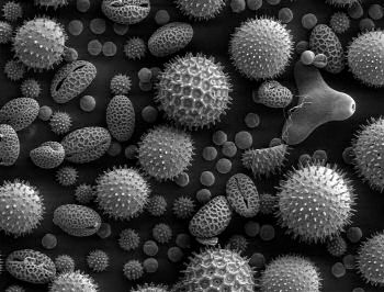 Springtime Pollen Allergies - Pollen grains