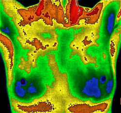 Thermography